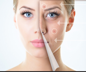 behandeling-acne-300×252 acne behandeling HUIDspreekuur